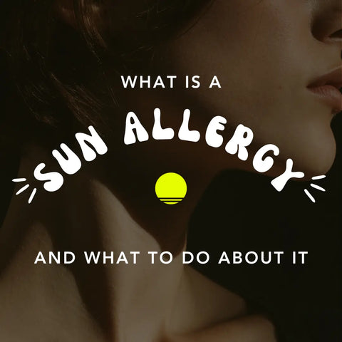 What to Do If You Have a Sun Allergy